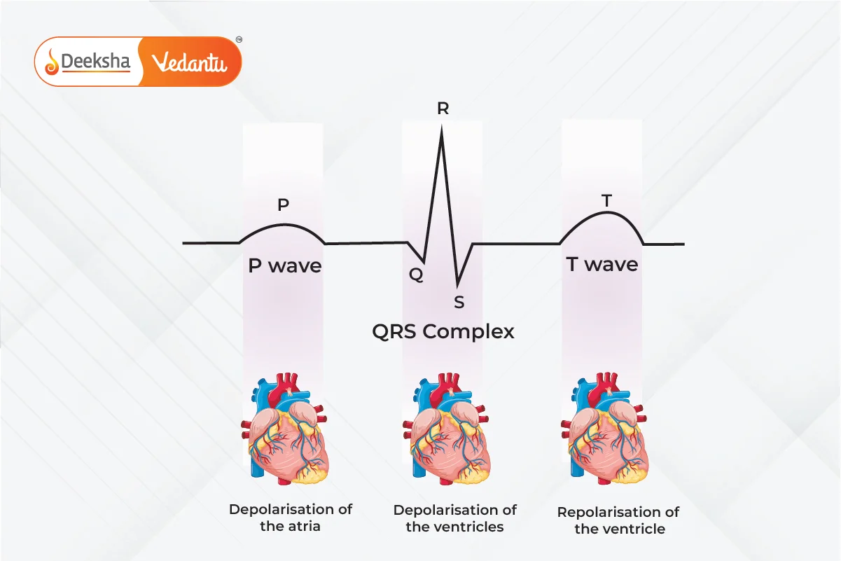 Electrocardiogram (ECG)