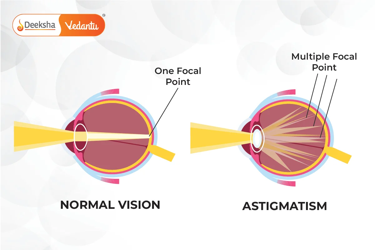 Defects Of Vision And Their Correction Class 10 Physics Defects Of Vision And Their Correction Class 10 Physics