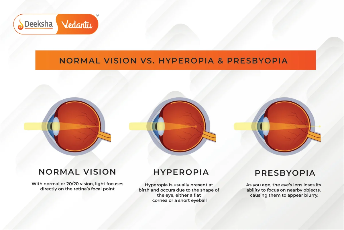 Presbyopia